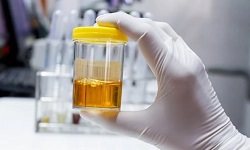 Urine Test